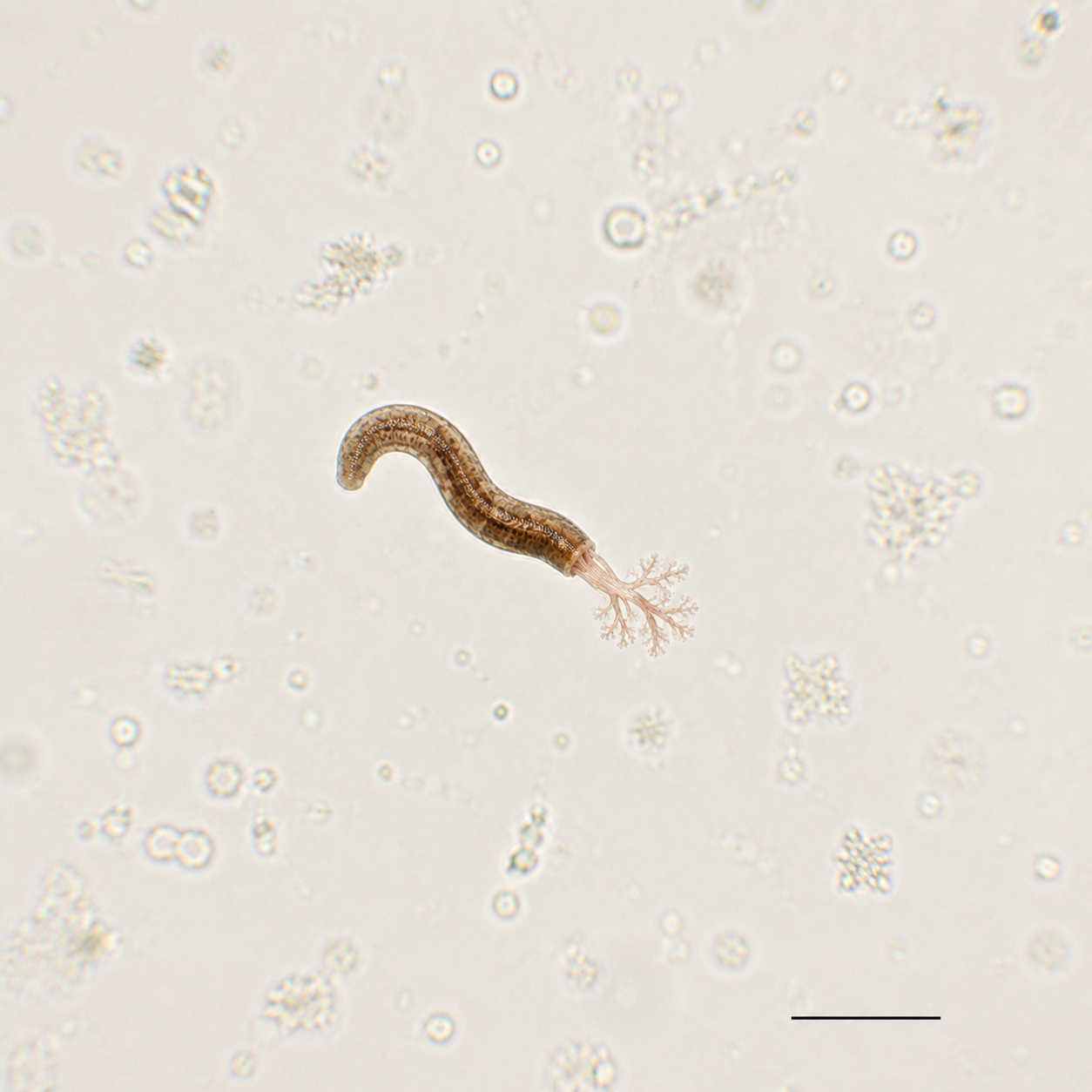 A solitary microscopic brown worm with small branching pink dendritic structures